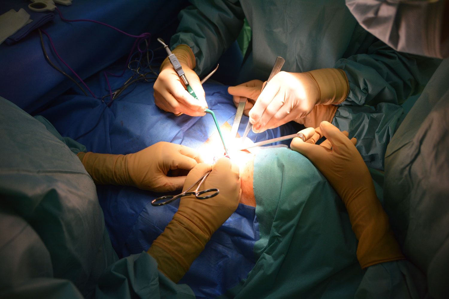 Equipe médica realiza procedimento em centro cirúrgico