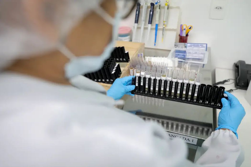 Teste laboratorial para malária em unidade de saúde